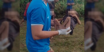 Fotos inéditas mostram que desnutrição ainda atinge crianças Yanomami