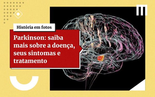 Beber café pode proteger cérebro do Parkinson, sugere pesquisa