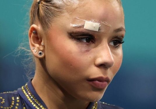 Ginasta Flávia Saraiva sofre queda e corta supercílio