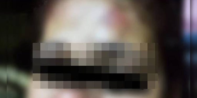 Fotos: homem esfaqueia mulher e fere filho de 3 anos com facada na mão