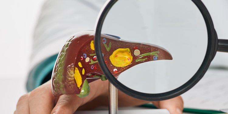 Quanto tempo demora para reduzir a gordura no fígado com bons hábitos