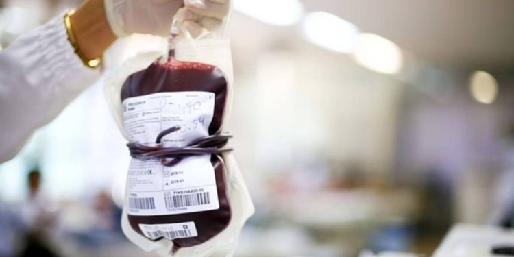 Rim do tipo sanguíneo A é convertido em O em busca de doação universal