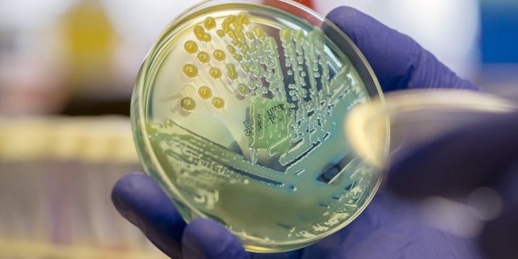 Saiba qual é a superbactéria que se espalhou pelo Hospital da Criança
