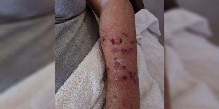 Garrafada e chute na cabeça: como idosa se livrou de ataque de cães