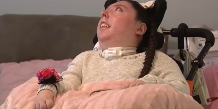 Jovem que nasceu sem cérebro desafia a medicina e completa 20 anos