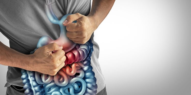 Cientistas desvendam mistério sobre a doença de Crohn com ajuda da IA