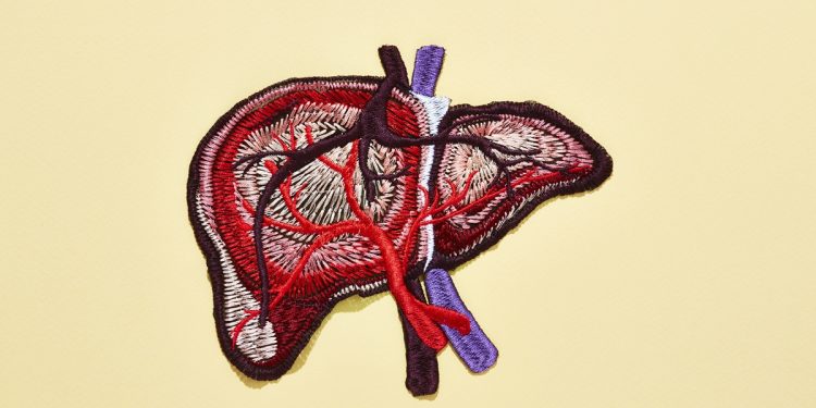 Gordura no fígado tem sintomas? Conheça sinais associados à condição