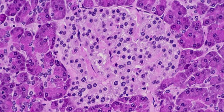 Resistência à insulina: sintomas da condição silenciosa pré-diabetes