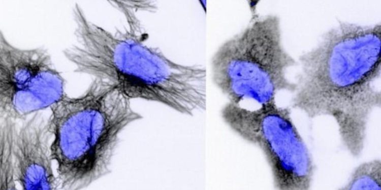 Tratamento potencial dribla resistência em câncer infantil agressivo