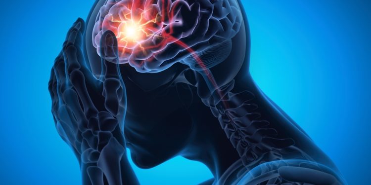 Neurologistas listam 4 hábitos que ajudam a reduzir o risco de AVC