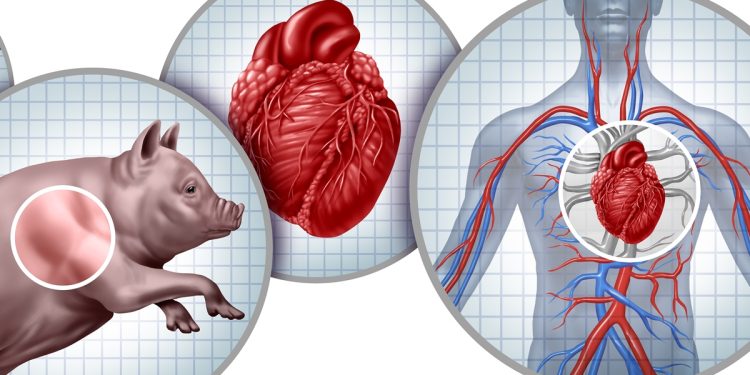 Xenotransplante: médicos dizem como técnica promissora avançou em 2025