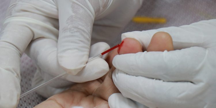 Endocrinologista explica como reconhecer sinais precoces da diabetes