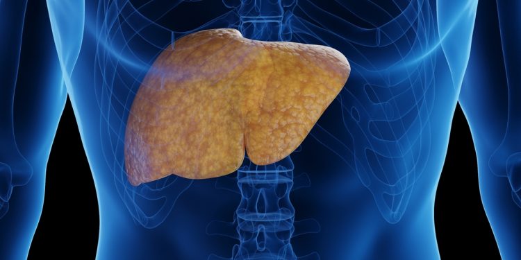 Hepatologistas contam os piores alimentos que causam gordura no fígado