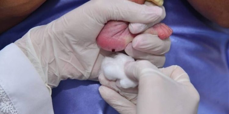 Teste do Pezinho terá mudança na rede pública do DF. Entenda