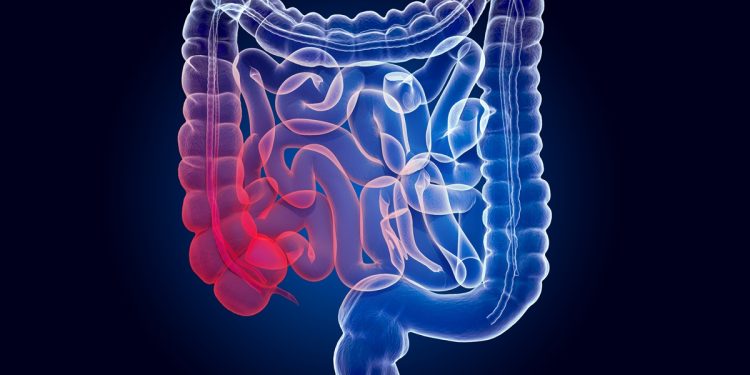 Oncologistas explicam quais exames detectam o câncer colorretal