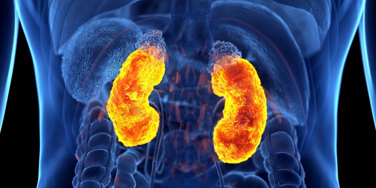 Oncologista explica sintomas do câncer nos rins, uma doença silenciosa