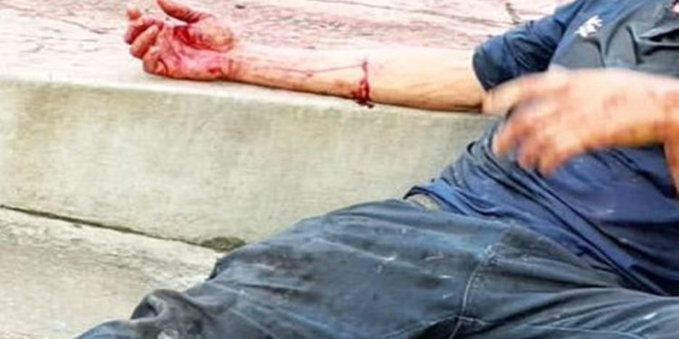 Homem é brutalmente espancado e fica coberto de sangue no DF