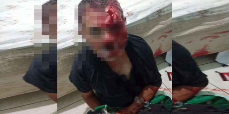 Homem que teve o rosto desfigurado por mascarada recebe alta