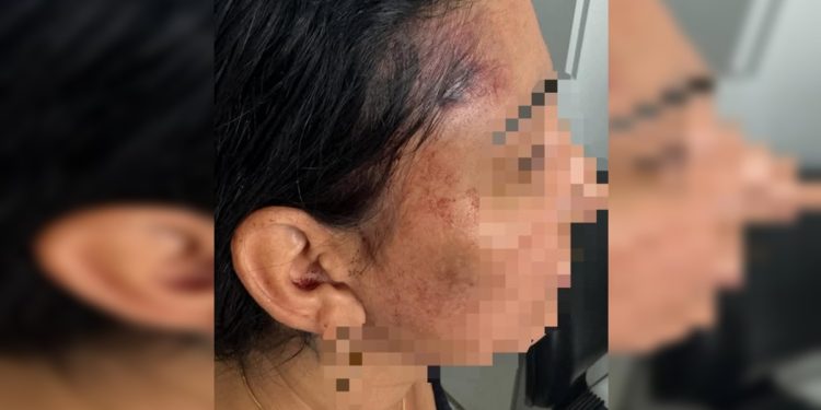 “Te mato”: homem é preso após ameaçar e agredir companheira com socos