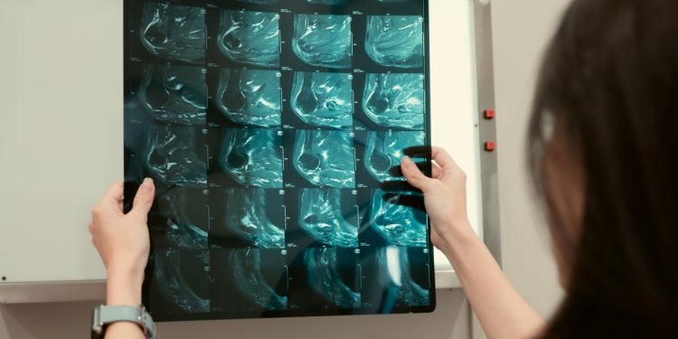 Oncologista conta 5 crenças sobre o câncer que atrapalham o tratamento