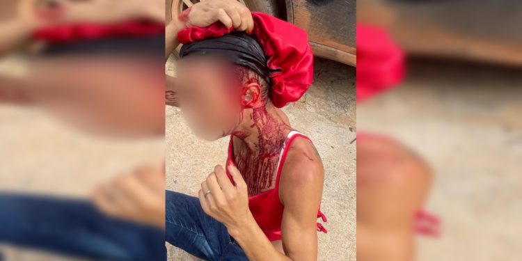 Mulher trans é brutalmente agredida com barra de ferro por homem no DF