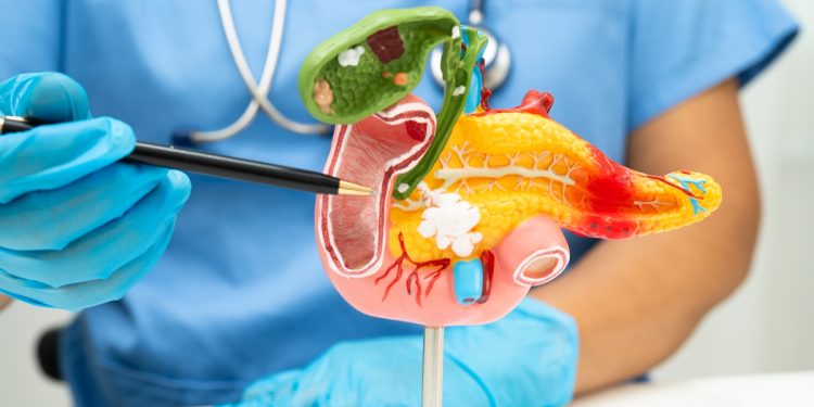 Gastroenterologistas explicam os principais sintomas de pancreatite