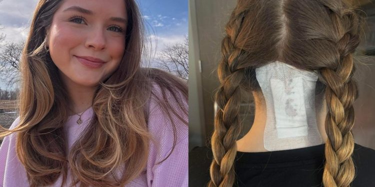 Jovem ignora tontura por anos até descobrir lesão na medula espinhal