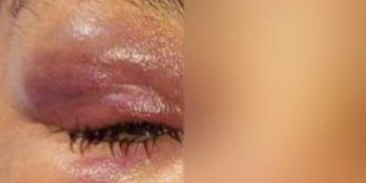 Suspeito de torturar e espancar mulher com corrente de ferro é preso