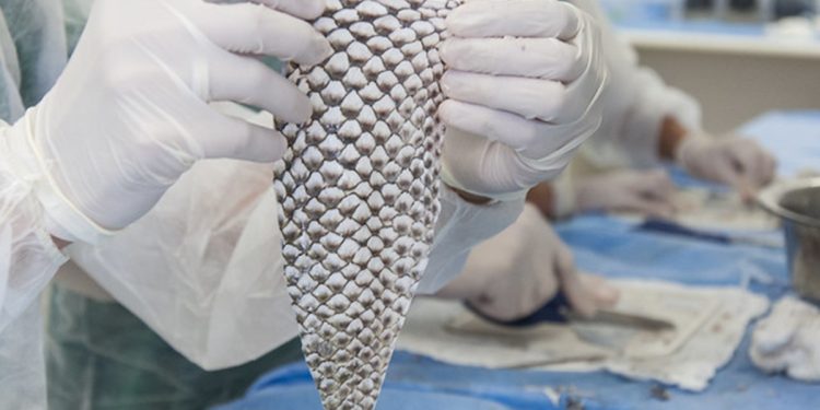 100% brasileira: técnica com pele de tilápia vai além de queimaduras