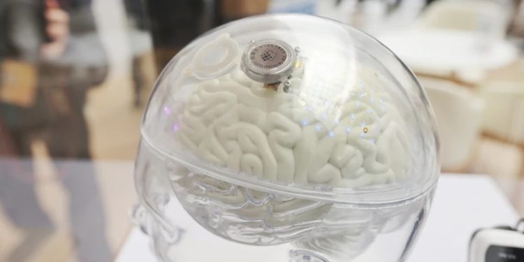 China aprova chip cerebral para uso clínico capaz de tratar paralisia