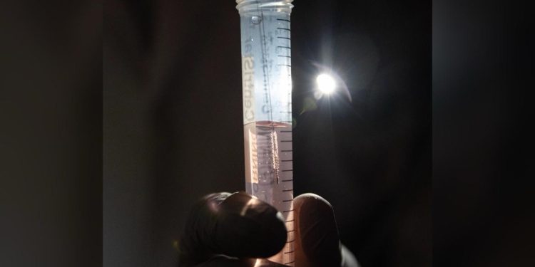 Teste com cotonete mostra boa eficácia para detectar Alzheimer precoce