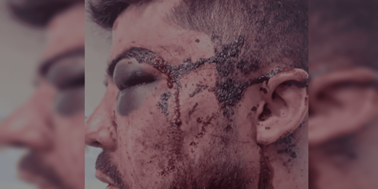 Caso de rapper espancado por 10 em bar da Asa Norte sofre reviravolta