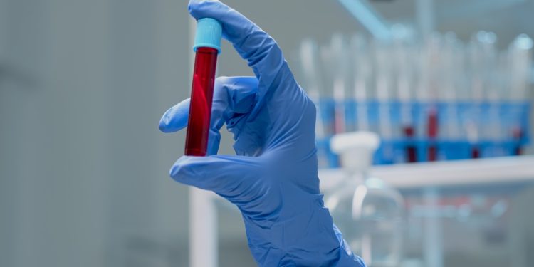 Estudo brasileiro cria exame de sangue para detectar câncer de mama