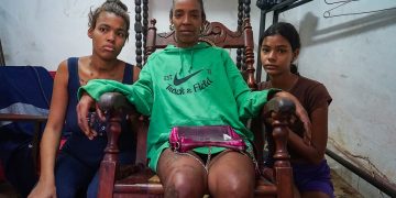 ‘Não há dignidade de nada’: Em Cuba, bloqueio dos EUA e apagões pioram vida de mulheres