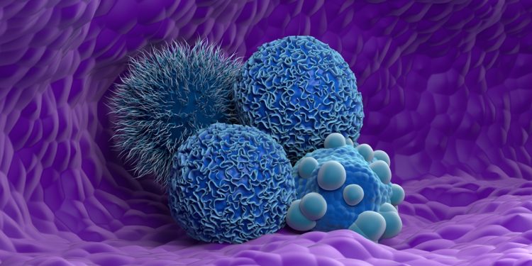 Tumores podem usar antioxidante como combustível, mostra estudo