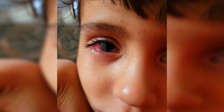 Menina de 6 anos corre contra o tempo para não perder a visão