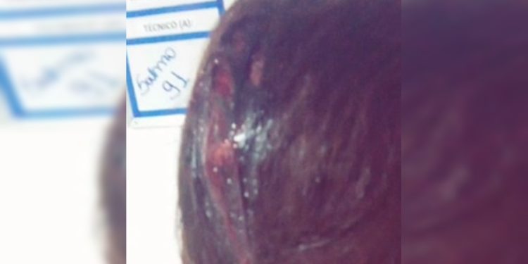 Mulher é apedrejada e foge de agressor no DF: “Vou te matar”