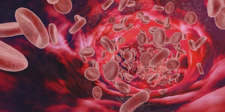 Anemia falciforme: entenda como é o tratamento e as crises da doença