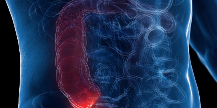 Gastro explica como reconhecer os principais sintomas da apendicite
