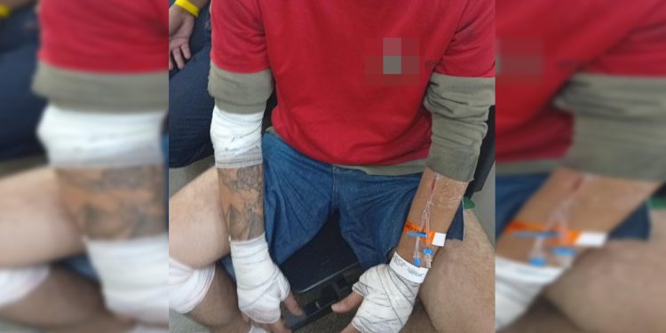 Motociclista quebra o baço após ser atingido por carro em via do DF. Veja vídeo