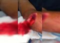 Homem é preso após tentar decepar cabeça de rival em briga no Entorno do DF