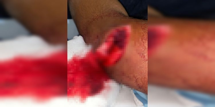 Homem é preso após tentar decepar cabeça de rival em briga no Entorno do DF