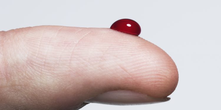 Novo RG poderá incluir diabetes tipo 1: entenda o que muda