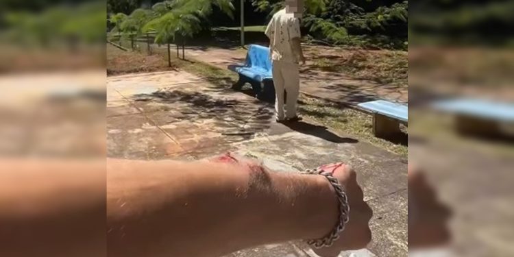 Homem relata agressão e braço quebrado após defender mulher no DF. Veja o vídeo