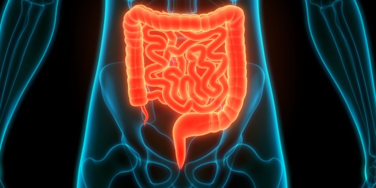 Como funciona o novo exame do SUS para detectar câncer de intestino