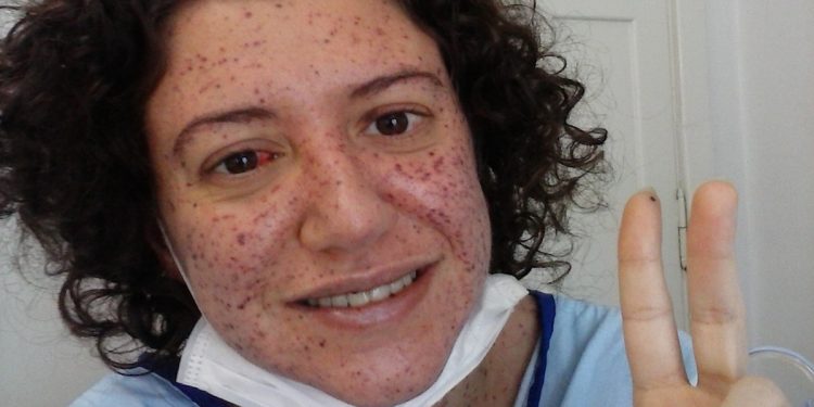 “Vivo com uma bomba-relógio dentro de mim”, diz mulher com doença rara