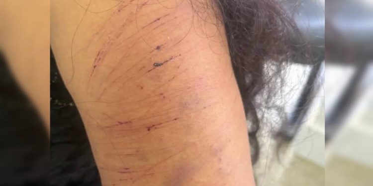 Mulher é atacada pelo ex no meio da rua a caminho de consulta com psicólogo