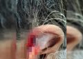 Neto arranca e engole pedaço da orelha da avó durante agressão