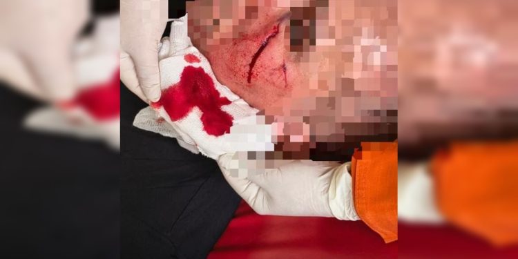 PM é atacado com telha durante ocorrência de violência doméstica