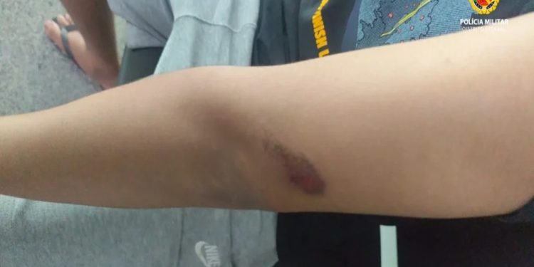Trio de adolescentes dá rasteira, socos e rouba menino de 15 anos